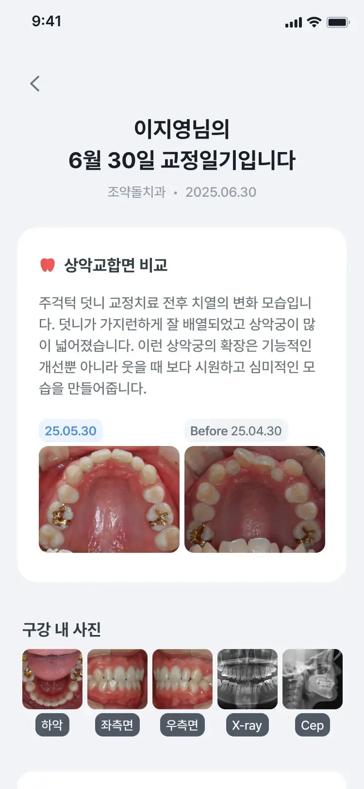 홈덴 앱 교정일기 화면